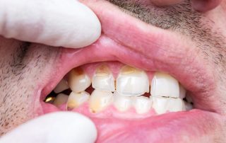 Dentist in Springfield, VA