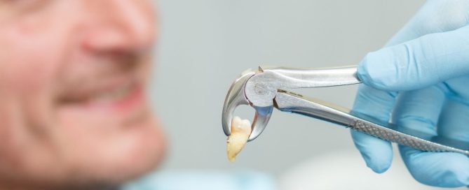 tooth extraction