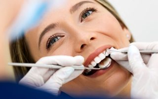 dental cleaning near Alexandria, VA