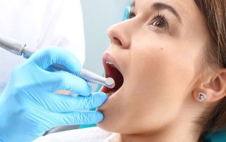 root canal treatment in Springfield, VA