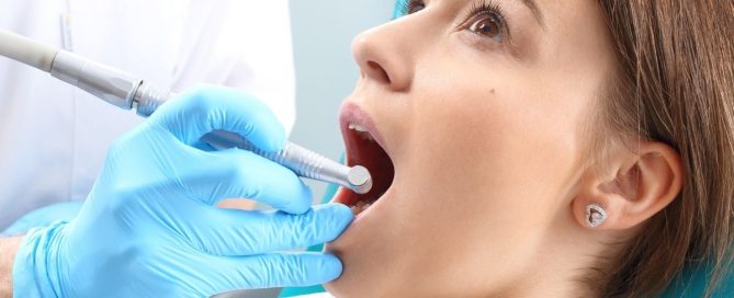 root canal treatment in Springfield, VA