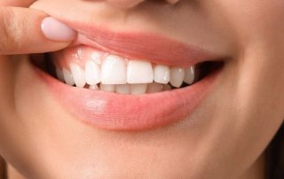 teeth contouring near Annandale, VA