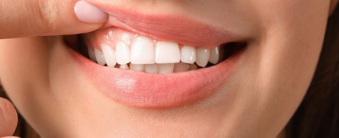 teeth contouring near Annandale, VA