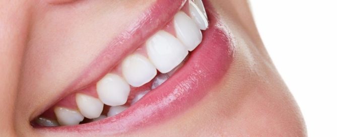 Dentist in Springfield VA performing cosmetic contouring to reshape uneven teeth for a smoother smile
